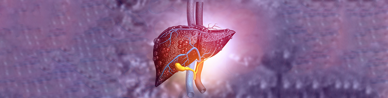 Liver cirrhosis: What it means and how it affects you